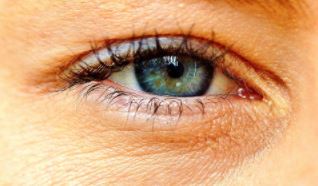 כל המידע על ניתוח קטרקט בעין