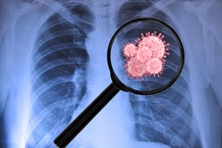 איך להתמגן מווירוס הקורונה בגיל מבוגר?