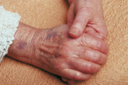 שימוש נכון במוצרי היגיינה יכולים למנוע מחלות עור בגיל השלישי