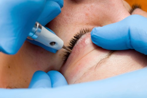 מתיחת עפעפיים בגיל השלישי - האם מומלץ?