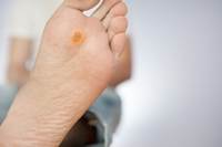 טיפול ביבלות בגיל הזהב